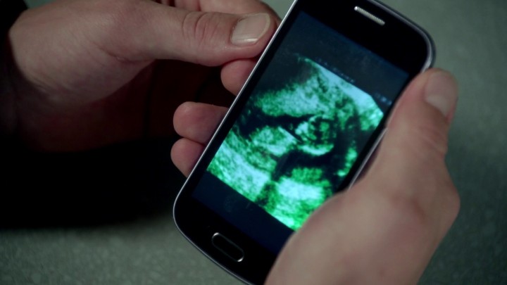 Once Upon a Time 5x03 Siege Perilous - Zelena sonogram